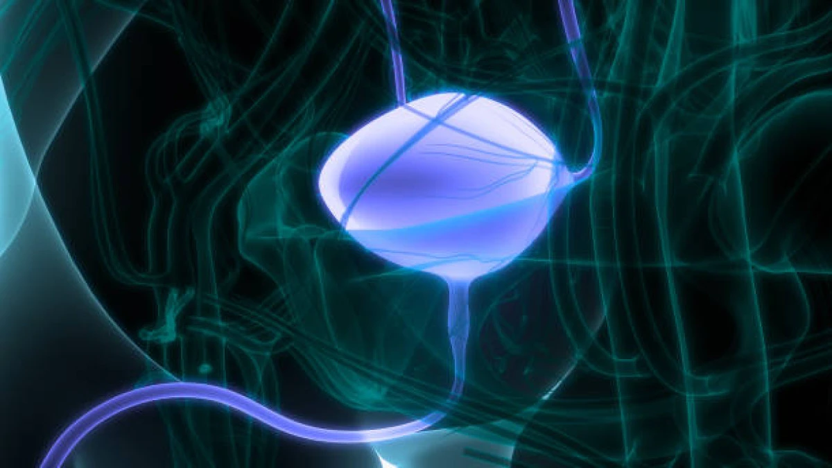 Uzman Uyarısı: Sırt Ağrısı ve Ağrısız İdrarda Kan Mesane Kanseri Belirtisi Olabilir!