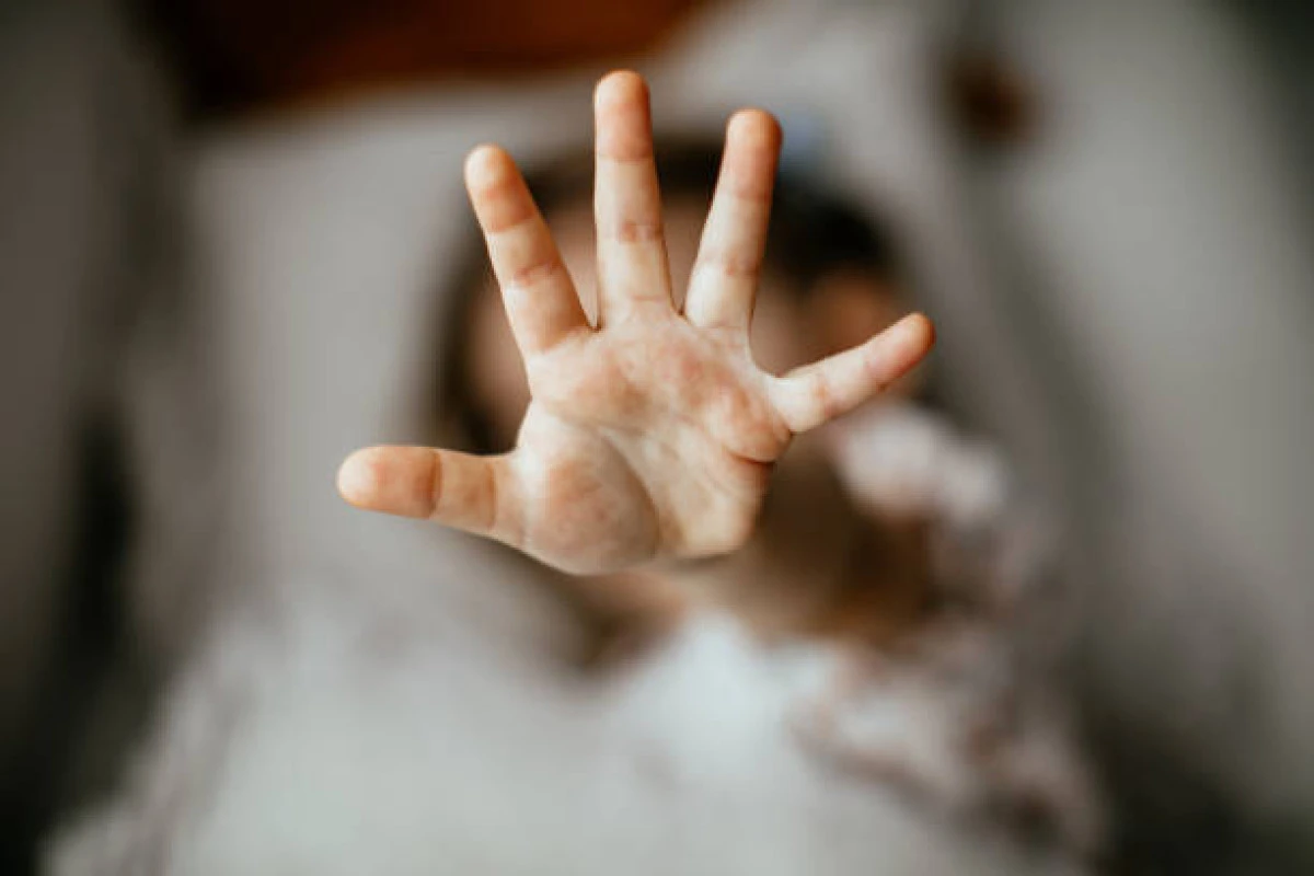 2020-2024 Arası İncelenen 864 Vaka: Acıbadem Üniversitesi ve İMDAT Derneği Raporunu Açıkladı